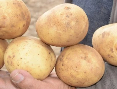 Δεν πάει το μυαλό σας: Τι θεραπεύουν οι τηγανιτές πατάτες;